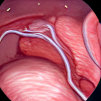BlufordOrbital